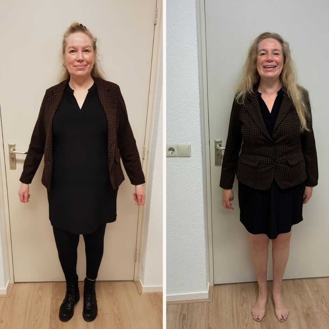 caro voor en na